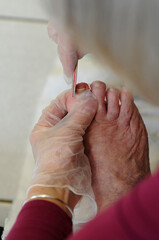 Podiatrist works on elderly patients feet.