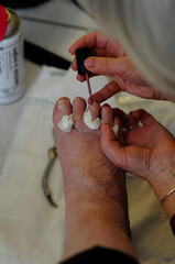 Podiatrist works on elderly patients feet.