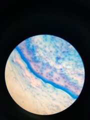 closeup photo of blood smear under microscope