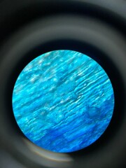 closeup photo of blood smear under microscope