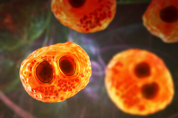 Cytomegalovirus CMV in human cell, owl's eye inclusion in nucleus