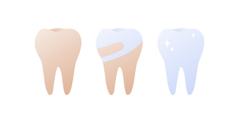 Tooth whitening, cleaning and stomatology concept. Vector flat healthcare illustration. Stages from yellow to clean white teeth. Design for dentistry