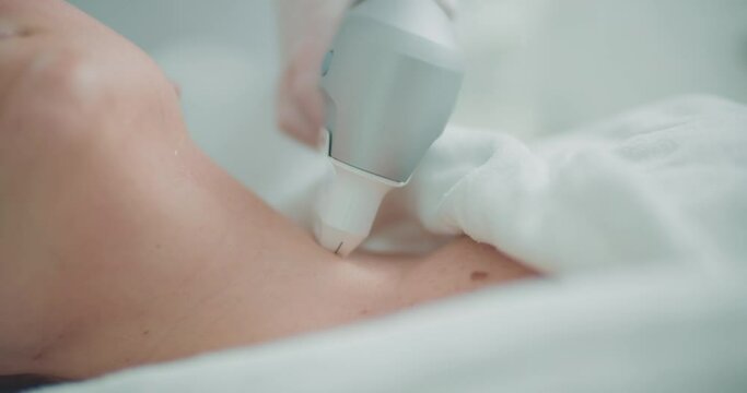 A close-up female client's neck is having a lifting procedure of neck by using the Ultraformer apparatus.