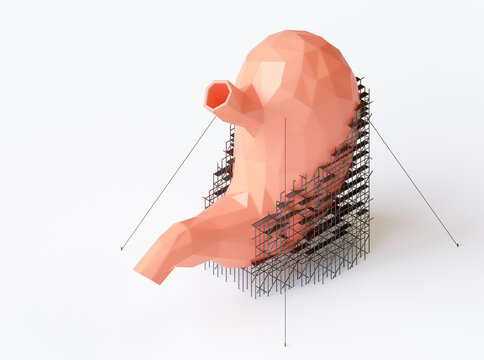 3d illustration of low poly human stomach repair concept. Isometric 3d render of stomach with scaffolding on it
