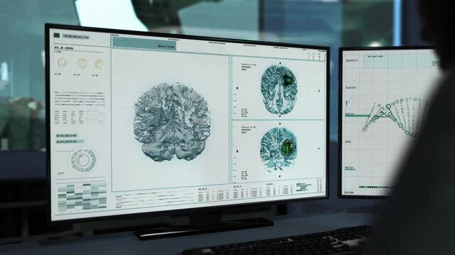 Patient`s Brain Diagnostic Process At A Modern Neurological Hospital. Brain Tumor Ct Scan Via High Tech Diagnostic System. Brain Diagnostic Medical Examination On A Modern Computer Program.