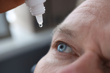 Man drips eye drops into eyes closeup