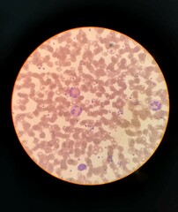 red blood cells in microscope in vector