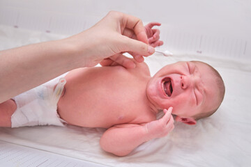 A mother cleans a crying newborn baby with a cotton swab. A baby in a diaper and mom's hands with a cotton swab