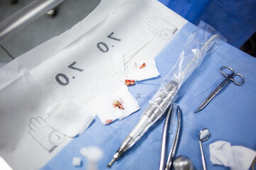 Extracted wisdom teeth on a medical tray table with dental tools and equipment. Wisdom tooth extraction surgery