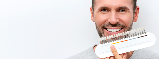 Smiling man with whitening shade guide