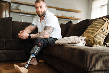 Mid aged white man with prosthetic leg