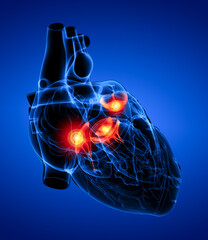 3d render Heart valve