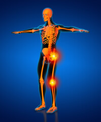 Skeleton of the man - side  view