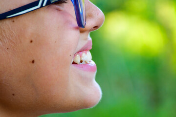 Close up of happy smile of little boy  with eyeglasses.  Dental medical care.  Dental  bruxism...