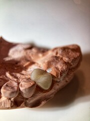 Tooth for dental crown placement.