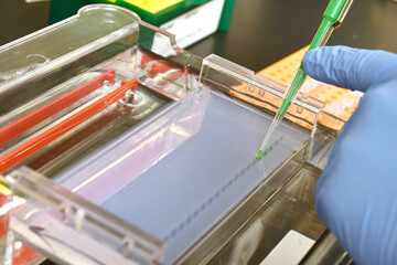 Researcher loading an electrophoresis gel with pipette