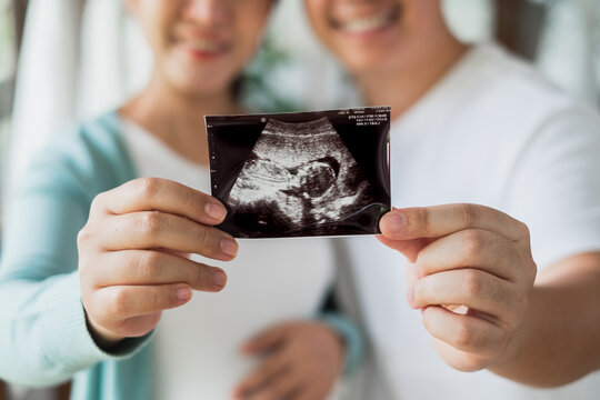 Asian pregnant couple feeling happy show ultrasound image at home, focus on ultrasound image