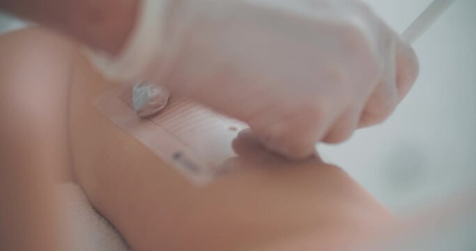 A cosmetologist is using a cosmetic pencil and stencil for painting white dods on the arm of a female client before the procedure.