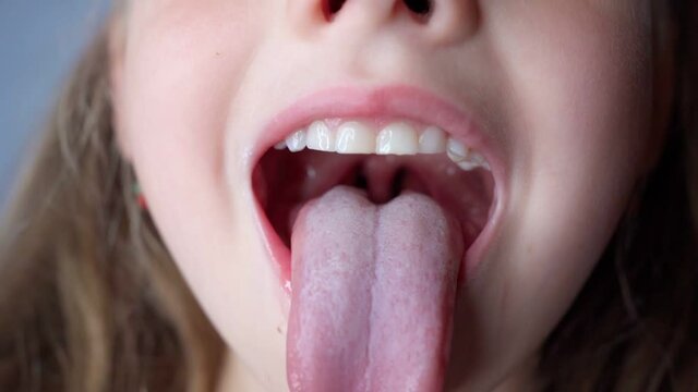 girl opens her mouth wide and pulls out long tongue. child shows his teeth soft palate and mouth to dentist. mouth is wide open, tongue is stuck out as far as possible, with clear view of tongue