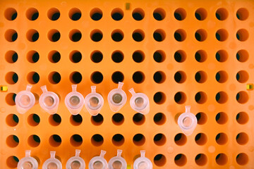 Overhead view of laboratory tube rack