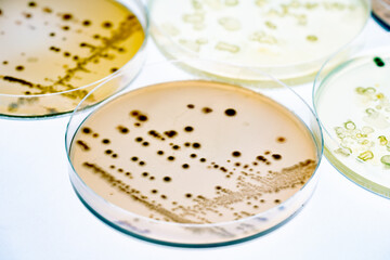 Mixed of bacteria colonies and fungus in various petri dish
