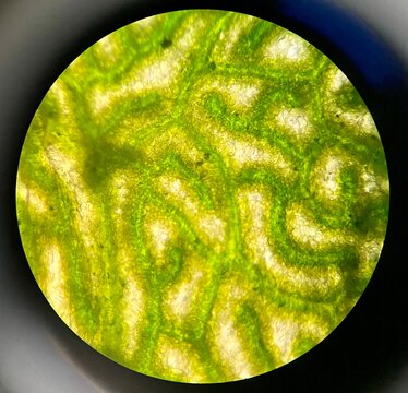 microscopic photo of the leaf of Portulaca oleracea plant
