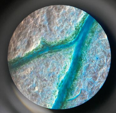 microscopic photo of the leaf of Portulaca oleracea plant