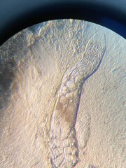 microscopic photo Demodex or face mites