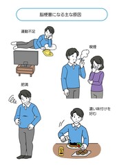 脳梗塞になる主な原因をまとめたイラスト