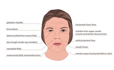 Facial wrinkles, illustration