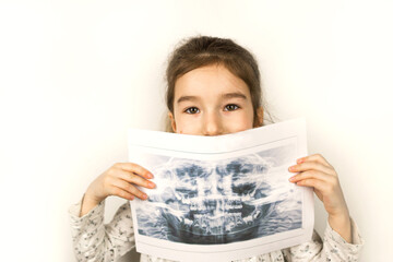 Girl holds her X-ray with a panorama of baby teeth and the second row of replaceable molars. Two...