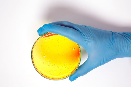 Hand holding a petri dish