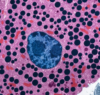 Pancreas, TEM