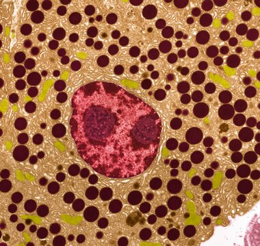 Pancreas, TEM