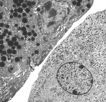 Pancreas, TEM