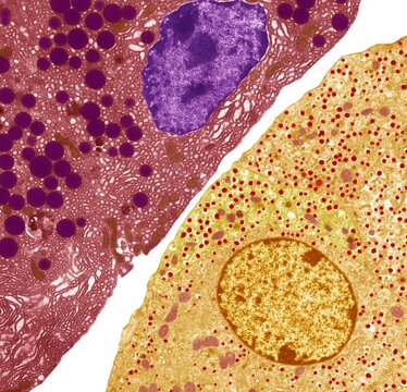 Pancreas, TEM