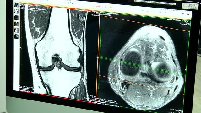 CT scan of patient in dynamic