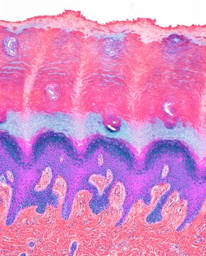 Plantar skin, LM