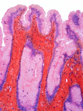 Stomach surface epithelium, LM