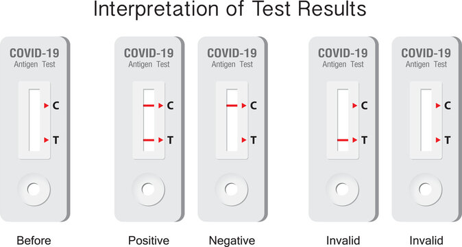 Interpretation of Covid-19 antigen test results. The infographic chart explains the reading of the results from the antigen test kit.