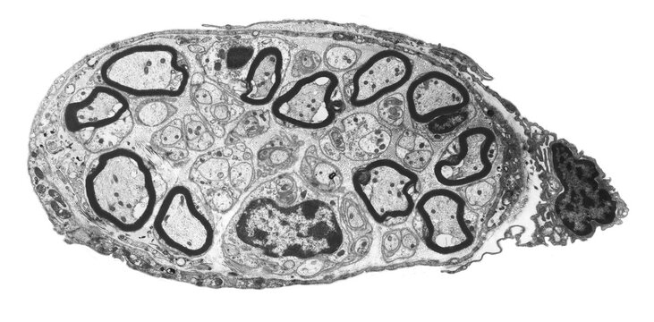 Peripheral nerve, TEM