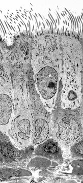 Trachea lining, TEM