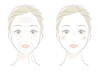 女性の顔のしわ