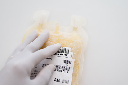 Blood Plasma Bag Photos and Premium High Res Pictures - Getty Images