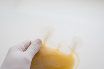 Close up scientist hand holding fresh frozen plasma bag in storage blood refrigerator at blood bank...