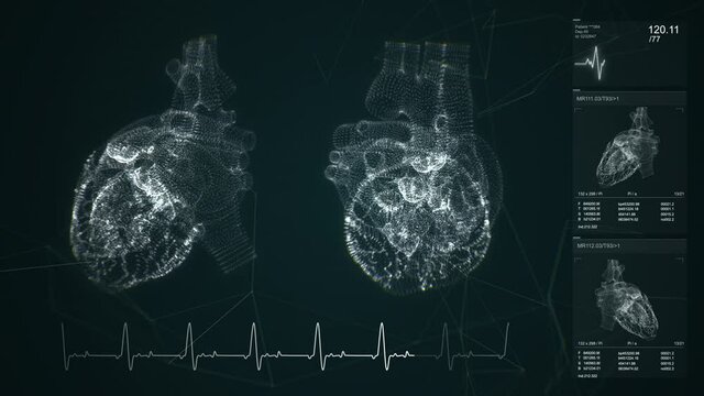 Dynamic pulsating heart. MRI scanning. Heart beat line. Cardiogram signal monitoring process. Patient&rsquo;s vital signs displayed on hospital screen. EKG, ECG curve. Pulse measuring. Medical 4K animation