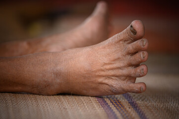 withered feet of old woman, withered tan skin, healthy and long live concept