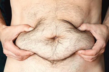 A man shows his fat belly