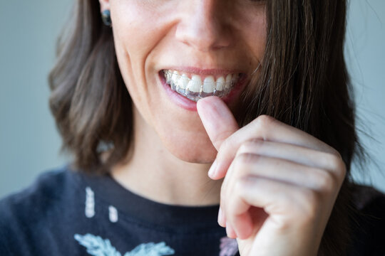 Beautiful smile and white teeth of a young woman