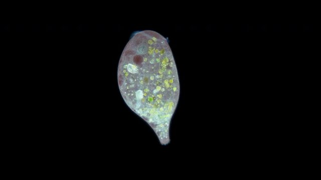 Stentor Ciliophora Infusoria under microscope, family Stentoridae, class Ciliata, order Heterotrichida, feed on small organic residues, bacteria, algae, protozoa.